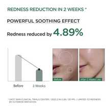 Anua Heartleaf LHA Moisture Peeling Gel 120ML - Purifying Exfoliating Gel - Gel - View 4