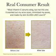 Serums & Facial Treatment - Vitamin C - View 6