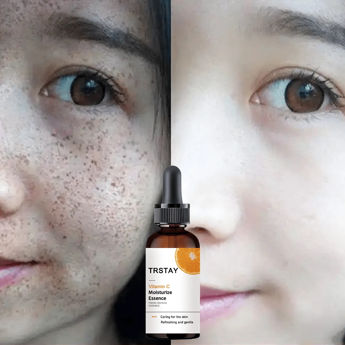 Vitamina C esencia hidratante facial, hidratación profunda para nutrir la piel, reducir las manchas oscuras, minimizar la pigmentación, adecuada para la piel oscura y desigual - Ácido hialurónico - Ver 1
