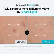 Mediheal Madecassoside Blemish Pad 100 Derma Pads - Toning Pads - Pads - View 4