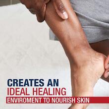 Severely Dry Skin Treatment Original Ointment 396g - Advanced Therapy Soothing Balm - Baume Apaisant - View 8