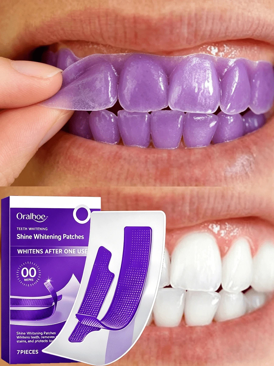 7pcs/Box,Teeth Whitening Patches, Quickly Whitens Teeth, Removes Stubborn Stains, Makes Teeth Shine Brightly, Gentle Care For Teeth Patch - 貼片 - 查看 1