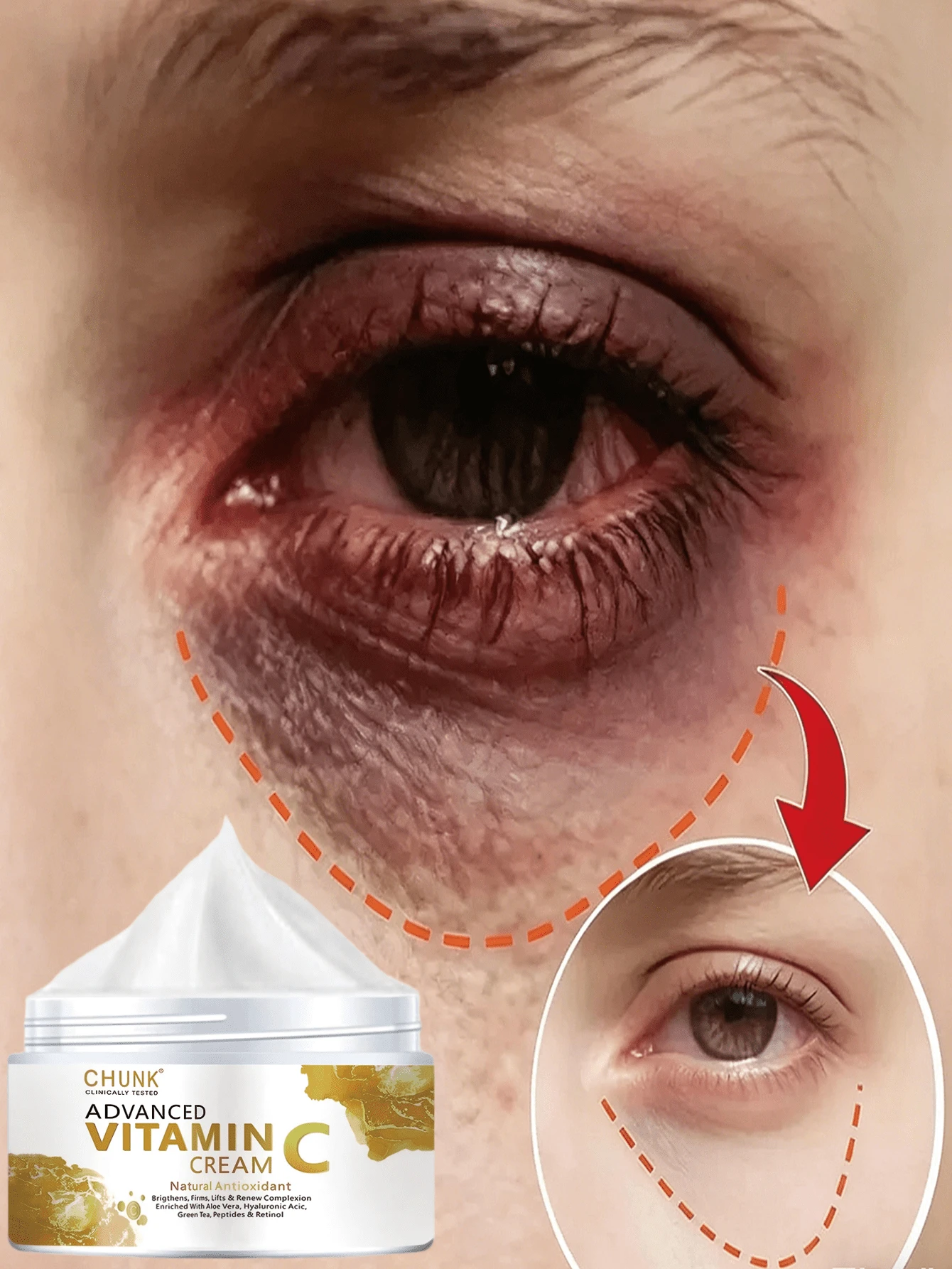 Crema hidratante rica en vitamina C, ácido hialurónico y vitamina E. Antienvejecimiento y antiedad natural, apta para hombres y mujeres. Promueve la producción de colágeno, ilumina el cutis, hidratación profunda, deja la piel tersa y luminosa. - Multicolor - Ver 1