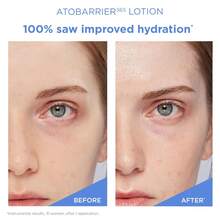 AESTURA - Ato Barrier 365 Lotion 150ML - Moisturizing Lotion - 洗劑 - 查看 5