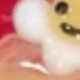 彩色