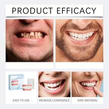 Carillas dentales blancas ajustables y cómodas, carillas decorativas para dientes superiores e inferiores, crean una sonrisa blanca profesional, regalo atento para los padres - Ver 5