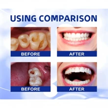 60ml Dental Care Liquid, Teeth Brightening Serum, Lasting Fresh Breath, Deep Cleaning Oral Hygiene, Removes Plaque & Stains, Gum Care For Yellow Teeth, Cavity Healing Tooth Armor, Keeps Mouth Clean White, Non-Gender Universal For Men Women, Summer Hot Item, Travel Wedding Beach Vacation Essential, Gifting Must-Have - trắng - Xem 9