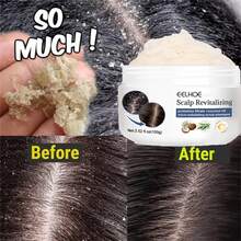 100g,Scalp Scrub, Deeply Cleanses Scalp Keratin, Improves Oil Secretion, Repairs Split Hair Frizz, Refreshing Hair Care, Promotes Hair Health, Increases Hair Luster, And Softens Hair Care Scrub - tẩy tế bào chết da đầu - Xem 2