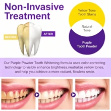 PurelyWHITE DELUXE Simply Purple Brightening Powder, Enamel No Sensitivity Toothpaste Whitening Powder, Conceals Stains From Coffee, Tea, Food, Wine And Tobacco, V34 Purple Toothpowder Teeth Cleaning Powder, Teeth Whitening Kit Deeply Moisturizes Hydrates Skin With Long Lasting Brightness, Enhanced Elasticity Vitality Boosting Formula For Radiant Smile - 藍色 - 查看 5