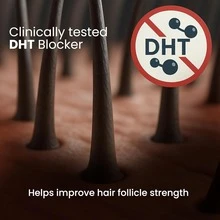 Botanical Hair Shedding Control Roll-On Serum | Triple Active Blend Of Rosemary, Redensyl & Anagain – Helps Reduce Shedding & Nourish Hair Roots | Unisex, 50 Ml - C - 查看 6