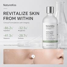 NatureKiss Activated Yeast Extract Essence Water, Hydrating & Moisturizing, Gentle Exfoliating, Brightening, 100ml Essence Toner - NatureKiss (Active Yeast Extract Water) - View 1