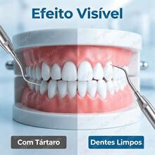 Limpador Dental Ultrassônico Portátil, Removedor de Tártaro e Manchas, Clareador Dental Doméstico - Branco - Visão 8