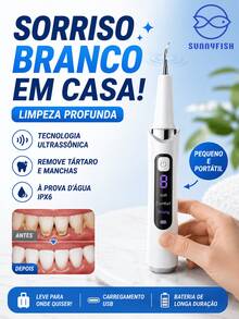 Limpador Dental Ultrassônico Portátil, Removedor de Tártaro e Manchas, Clareador Dental Doméstico - Branco - Visão 2