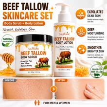 Tallow & Honey Skin Softening Moisturizing Set (200g Body Scrub + 100ml Body Lotion), Contains Grass-Fed Tallow, Manuka Honey, Niacinamide & Shea Butter, For Gentle Exfoliation, Improving Rough Chicken Skin, Deep Moisturizing, Softening & Brightening Skin, Suitable For Men And Women - All - View 1