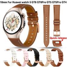 18mm Quick Release Women's Watch Band, Compatible With Huawei Watch GT 6/5/GT4/GT5 41mm And GT5Pro 42mm, Compatible With Forerunner 265S/255S, Venu 4 41mm/2S/3S, Vivomove 3S/4S And Other Smartwatches, Suitable For B5/S/S1 And Other Watch Band Accessories. - 18mm - View 13