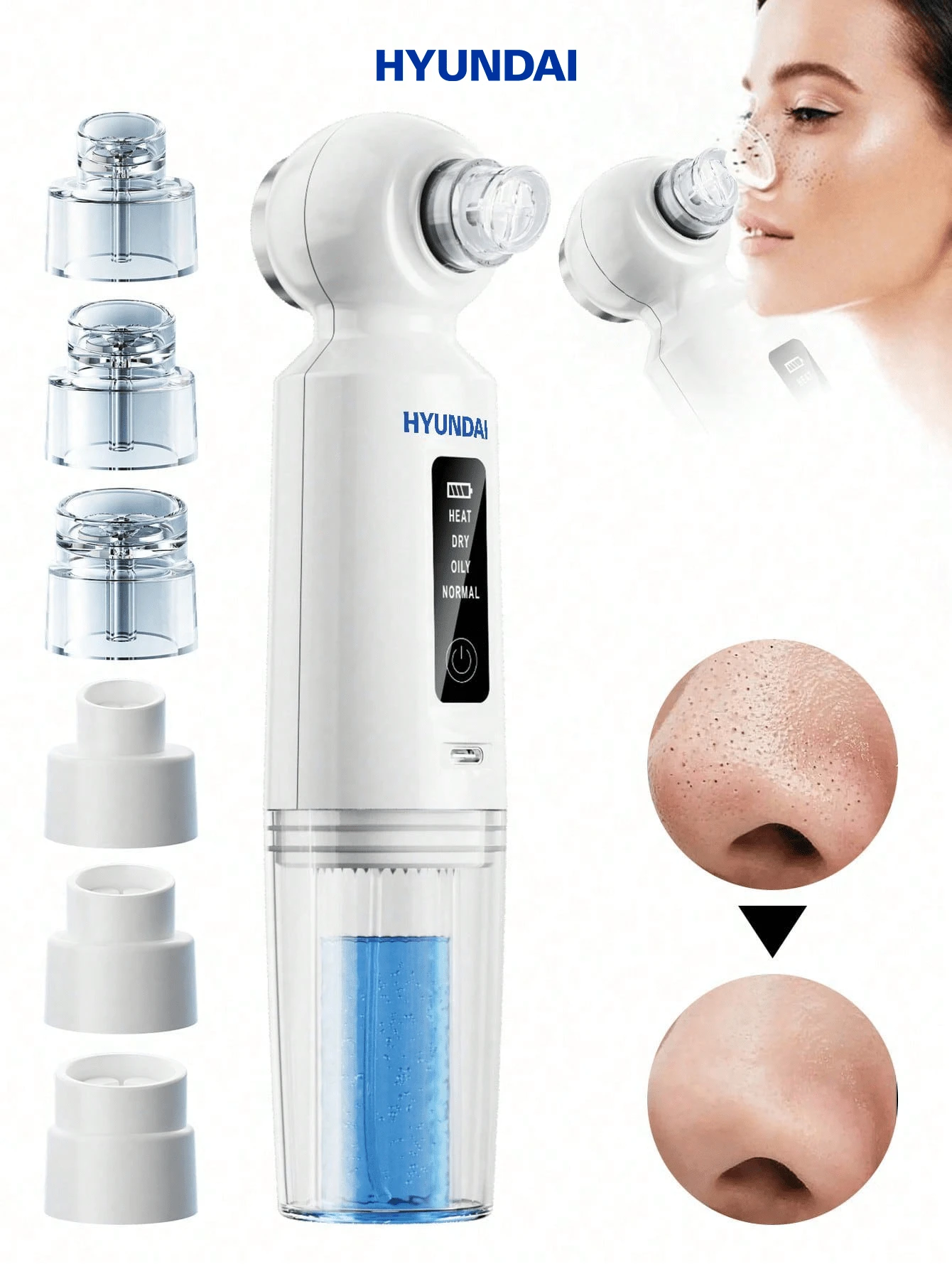 HYUNDAI 6-In-1 Electric Blackhead Remover Tool With Heating Function, Portable USB Rechargeable Pore Cleaner For Effective Facial Cleansing And Blackhead Removal - White - View 1