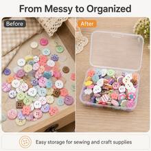 Juego de botones de colores en caja de 30/40/60/80/90/100 piezas, botones decorativos versátiles para ropa, manualidades DIY y artesanías creativas, adecuados para ropa DIY, suéteres y decoración de artesanías, estilos aleatorios - Multicolor - Ver 4