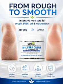 40% Urea Cream With 2% Salicylic Acid – Intensive Repair Moisturizer For Cracked Heels, Dry Hands, Scaly Elbows & Rough Knees – Enriched With Aloe Vera, Coconut Oil & Tea Tree Oil (113g) - Full Size - View 7