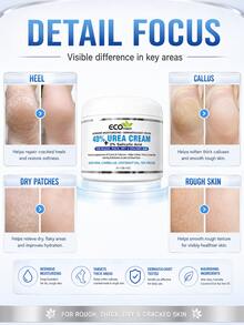 40% Urea Cream With 2% Salicylic Acid – Intensive Repair Moisturizer For Cracked Heels, Dry Hands, Scaly Elbows & Rough Knees – Enriched With Aloe Vera, Coconut Oil & Tea Tree Oil (113g) - Full Size - View 3