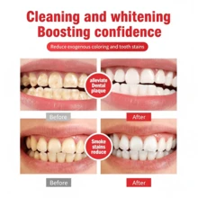 26pcs (24pcs 9D Whitening Toothpaste + 2pcs Whitening Toothpaste) Toothpaste Set For Teeth Whitening, Toothpaste For Freshening Breath And Toothpaste, Whitening Set To Remove Dental Stains And Yellow Teeth - Mint - View 7
