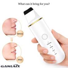 GANLAIX USB充電式電動洗臉機 震動臉部刮痧黑頭清除器 去角質提拉護膚美容儀 便攜旅行聖誕禮物 - 彩色 - 查看 7