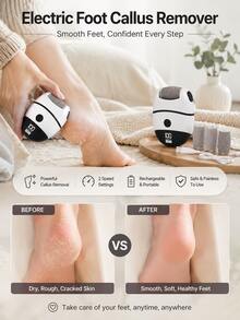Electric Foot Callus Remover, Equipped With 6 Replaceable Grinding Heads, Professional Callus Remover, Electric Foot File And Skin Exfoliator, Can Polish Foot Skin, 2-Speed Adjustment, USB Charging, 500mAh Lithium Battery, Compact And Portable - Multicolor - View 2