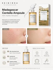 SKIN1004 100ml Sérum de Reparação Profunda de Centella Asiatica de Madagascar, Hidratante & Reparador, Essência Facial, Não Irritante, Cuidados Faciais, Adequado para Mulheres e Homens, Uso Diurno e Noturno, Cuidados Faciais - essência de ampola - Visão 9