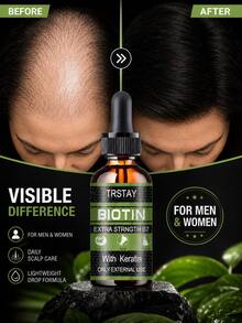 Textura de cabello frágil, aceite esencial anti-caída, raíces de cabello fuertes, reducción de pérdida de cabello anormal, creando visualmente un efecto esponjoso y denso - Multicolor - Ver 7