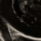 A1