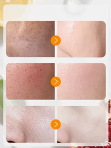 Garnier 卡尼爾亮采維他命C精華液，幫助淡化黑斑、減少色素沉著、增強肌膚光澤並提亮膚色。這款晚間精華液專為改善暗沉、蠟黃肌膚而配方，含10%純維他命C，具有 - 15ml - 查看 2