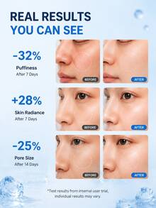 Dispositivo de compresión fría facial de acero inoxidable con espejo, rodillo de hielo, instrumento de belleza, dispositivo de compresión de hielo facial - Multicolor - Ver 5