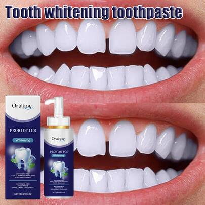 pasta de dientes para prevenir la caries dental y eliminar eficazmente la placa dental