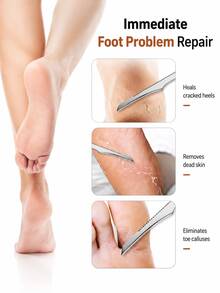 3pcs Stainless Steel Foot File Tools, Professional Foot Callus And Dead Skin Remover, Unisex Foot Care Tools (With Protective Cover) - F - View 4