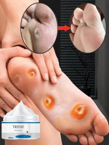 Deeply Moisturize Dry Cracked Feet Repair Rough Skin Remove Dead Cells Essential Foot Care For Year Round Hydration And Smoothness Foot Cream For Dry Cracked Heels And Calluses Intensive Moisturizing Treatment - Multicolor - View 1