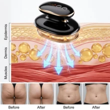 New Weight Loss Body Shaping Fat Burning Device, USB Rechargeable Colorful Slimming Massage Tool For Women Home Use, Mother's Day - 黑色 - 查看 6