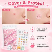120 piezas de parches para el cuidado del acné, fórmula suave para el cuidado de la piel, protección transpirable y nutritiva amigable con la piel, parches portátiles para el acné - Ver 6