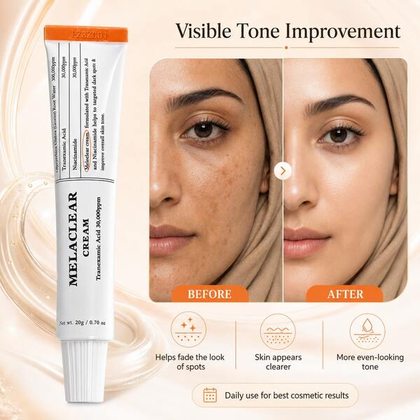 Niacinamide Face Cream, Brightens Skin Tone And Improves Dullness, Fades Acne Marks And Pigmentation, Deeply Hydrates And Locks In Moisture, Soothes And Repairs Skin Barrier, Refreshing And Non-Greasy, Suitable For All Skin Types