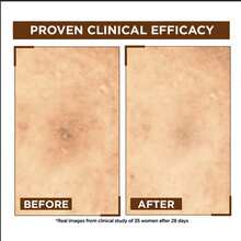 Garnier Serums & Facial Treatment - Retinol - View 3