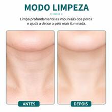 Massageador com LED- Sortido - Visão 6
