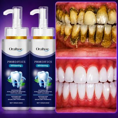 oralhoe Whitening Toothpaste, Probiotics Toothpaste For Teeth Whitening & Stain Removal, Fresh Breath Toothpaste For Yellow Teeth, Gentle Oral Care Dental Toothpaste, Daily Teeth Cleaning And Smile Care