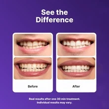 Purple Teeth Whitening Strips 21 Treatments - Non Sensitive Teeth Whitening - Whitening Without Any Harm - Pack Of 42 Strips - PURPLE - View 3