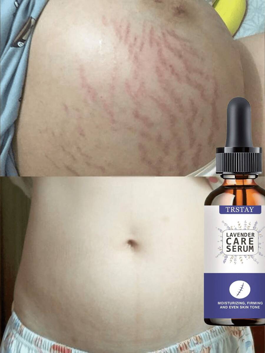 TRSTAY Moisturizing Body Serum, Silky Refreshing Essence For Dry Body Skin, Spreads Smoothly Without Sticky Residue, Supports A Soft Comfortable Touch, Suitable For Women And Men, Ideal After Bathing - Multicolor - View 1