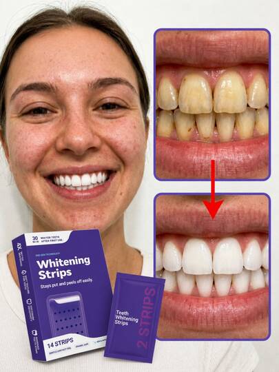 Purple Teeth Whitening Strips, Mint, Get Rid Of Smoke Stains, Coffee Stains, Tea Stains, Keep Your Mouth Clean And White, Good Choice For Vacation, Beach, Travel Essentials, Suitable For Summer Oral Care