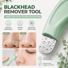 Ferramenta de Remoção de Cravos, Raspador de Poros Faciais em Aço Inoxidável para Limpeza Profunda de Poros, Ferramenta de Limpeza de Cravos e Colher de Raspagem para Cuidados com Acne, Ferramenta de Raspagem para Cuidados com a Pele com Cabo Ergonômico, Ferramenta Portátil de Limpeza Facial, Adequada para Uso Doméstico, Viagem, Spa e Uso Diário - Multicolorido - Visão 1