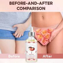 EELHOE 30ml,Ladies' Care Essential Oil, Deeply Nourishes Bikini Areas, Eliminates Odors, Provides Dry Care, Maintains Moisture In Private Parts, Maintains Ph Value, And Gently Cleanses The Body And Skin - 草莓 - 查看 6