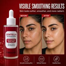 Centella Asiatica AHA Exfoliating Facial Serum, Lightweight Daily Skin Renewal Care, Suitable For Dull And Uneven Skin - AHA - View 1