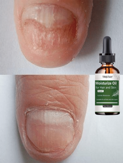 Essential Oil For Nail Care, Moisturizing Effect, Soft And Healthy Nails, Helps Strengthen, Protect And Maintain A Flawless Appearance, Ideal For Professional Manicures And Pedicures