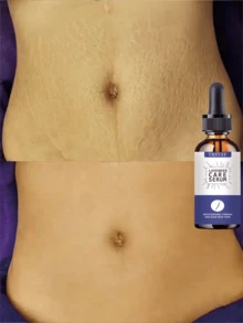 TRSTAY Milky Body Serum, Lightweight Fluid Texture For Dry Rough Body Skin, Glides Smoothly And Absorbs Without Greasy Buildup, Leaves Skin Feeling Soft Supple And Comfortable, Suitable For Shower Care, Daily Layering, Travel, And Seasonal Skincare - Multicolor - View 4