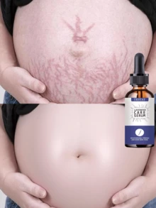 TRSTAY Milky Body Serum, Lightweight Fluid Texture For Dry Rough Body Skin, Glides Smoothly And Absorbs Without Greasy Buildup, Leaves Skin Feeling Soft Supple And Comfortable, Suitable For Shower Care, Daily Layering, Travel, And Seasonal Skincare - Multicolor - View 1