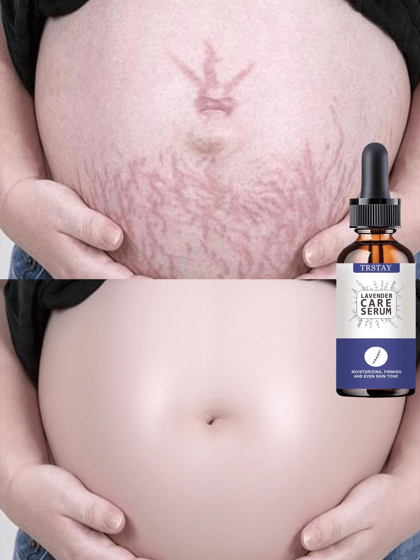 TRSTAY Milky Body Serum, Lightweight Fluid Texture For Dry Rough Body Skin, Glides Smoothly And Absorbs Without Greasy Buildup, Leaves Skin Feeling Soft Supple And Comfortable, Suitable For Shower Care, Daily Layering, Travel, And Seasonal Skincare - Multicolor - View 1